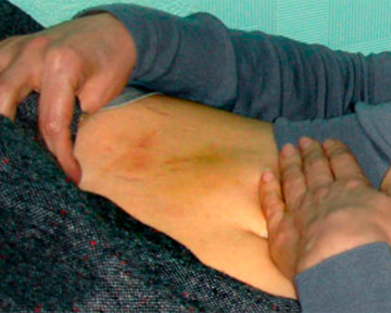 Файл:Тимошенко - синяки 1.jpg